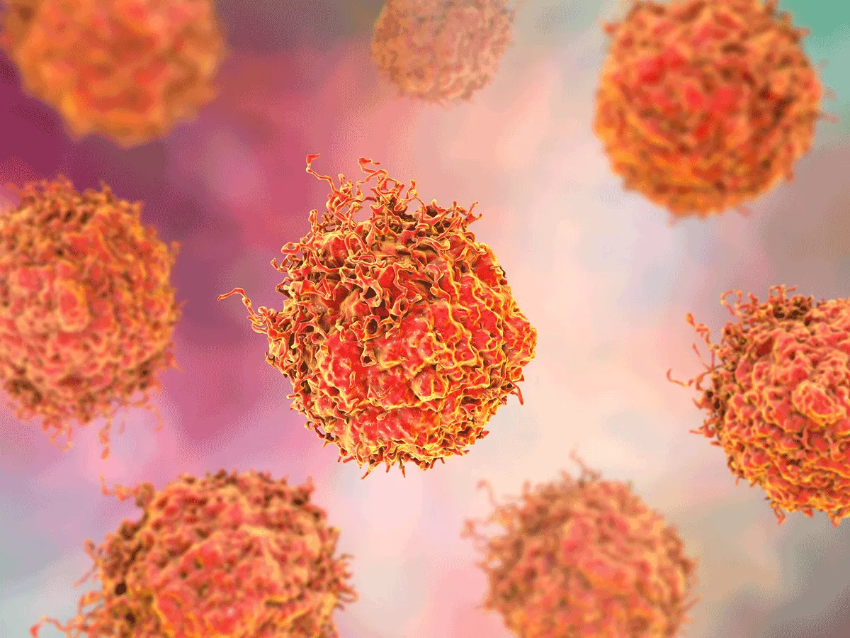 Prostate cancer cells Prostate cancer cells