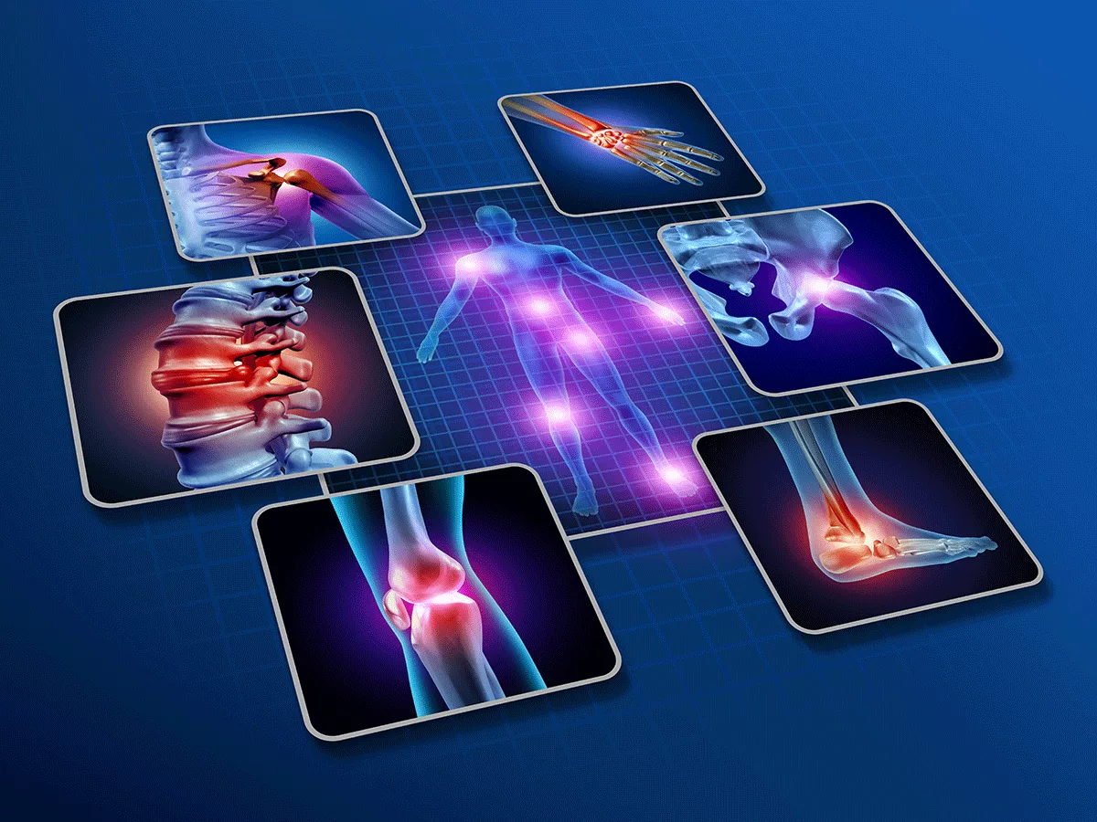 Pain illustration Pain illustration