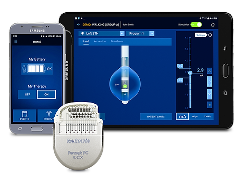 Deep brain stimulation
