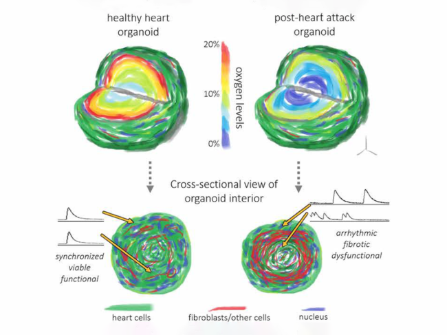 Diagram comparing healthy heart organoid to post-heart attack organoid