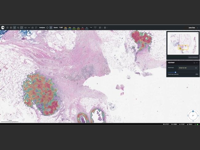 Software screenshot showing histology image