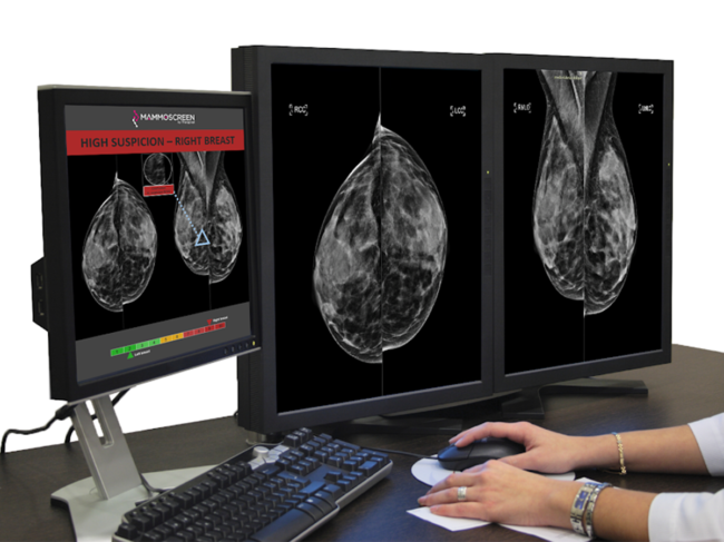 Computer screens displaying Mammoscreen software