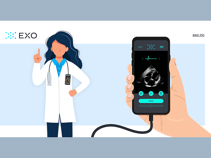 Exo Imaging scoops up 40M in series B+ funding to boost handheld