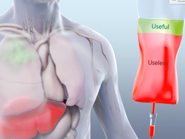 Illustration of liver, intravenous therapeutics