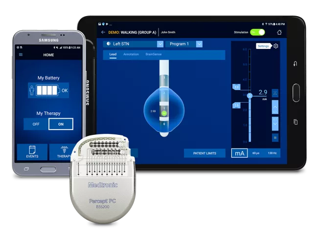 1-9-medtronic-percept-dbs.png