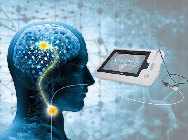 Device, head and neck illustration