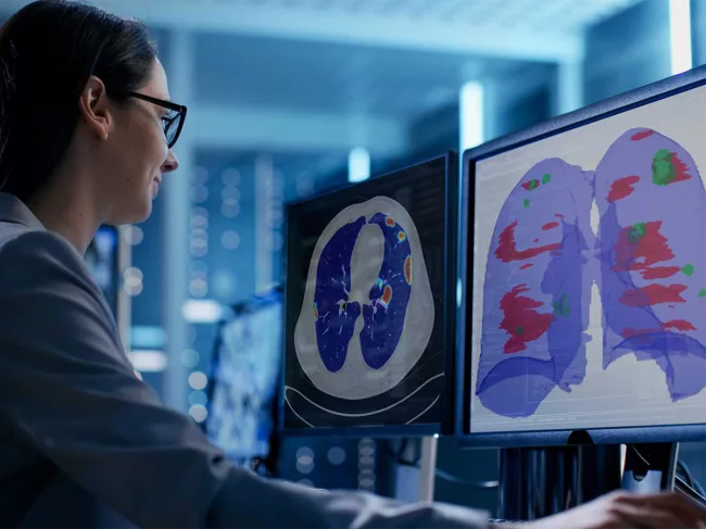 Radiologist using computer software