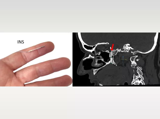 Device on finger, in brain scan