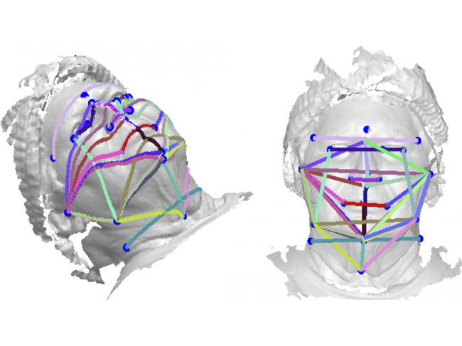 Points of measurement in 3D head scan  