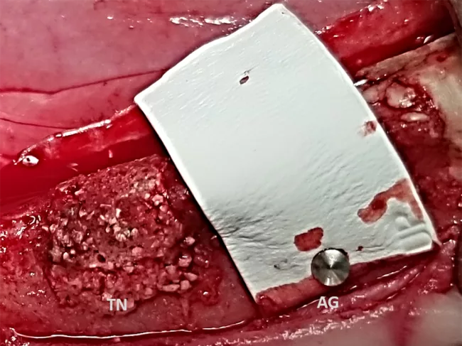 Jawbone with standard of care and Launchpad's product