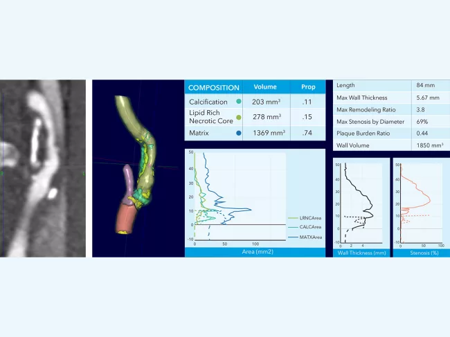 CT scan vs. software screenshot