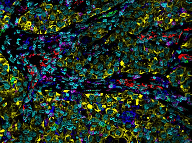 Image from Ionpath MIBIscope