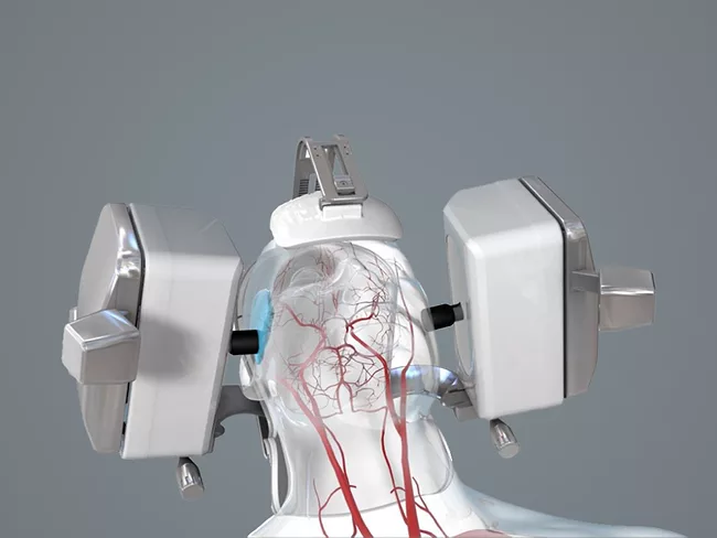Illustration of head, brain blood flow with Novaguide