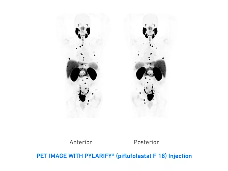 why is my glp 1 injection site itchy Sudden itching at injection site : r/Mounjaro
