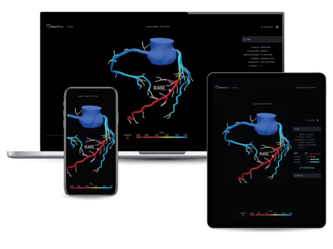 Heartflow software on different devices