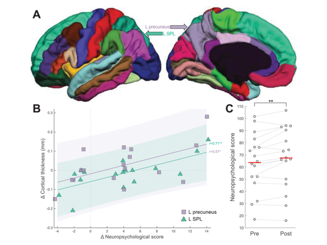 Figure from journal article showing brain–behavior correlations