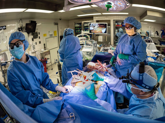 Surgeons in operating room performing open heart surgery