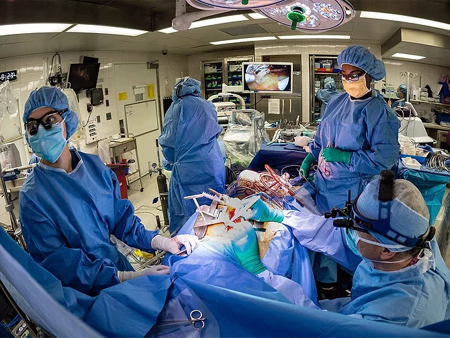 Surgeons in operating room performing open heart surgery