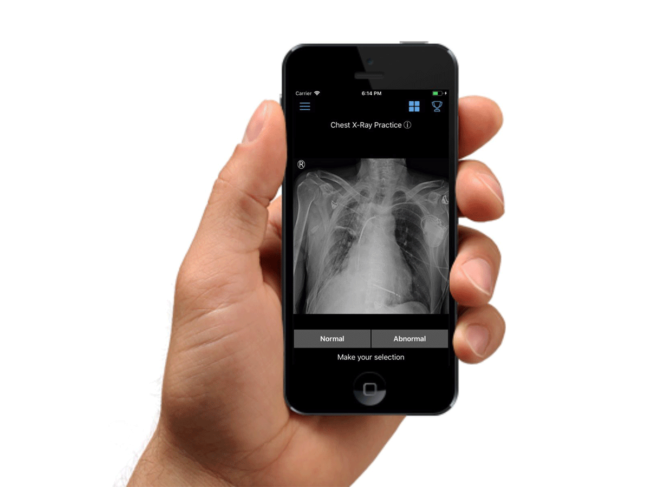 Hand holding a smartphone with Diagnosus app