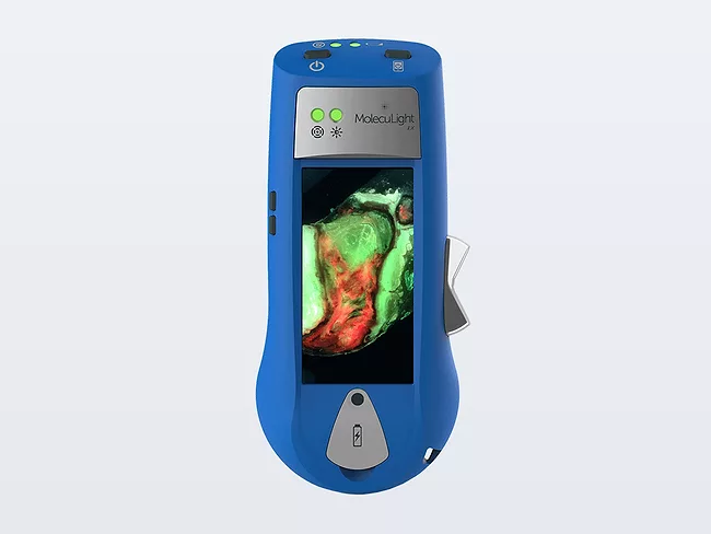 Moleculight i:X device