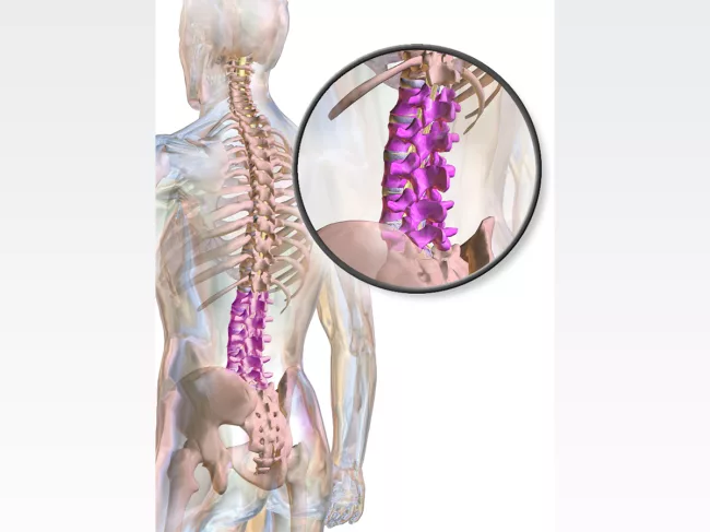 Human anatomy illustration with lumbar spine highlighted in purple