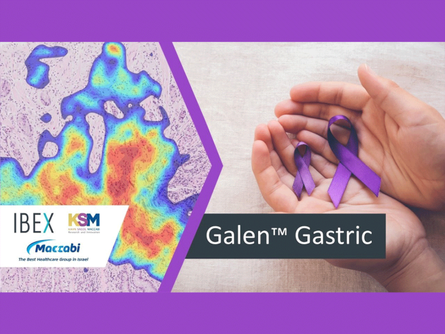 Galen Gastric concept image