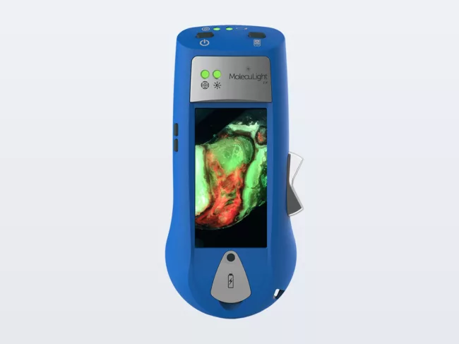 Moleculight i:X device