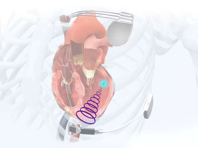 Illustration of the WiSE system components