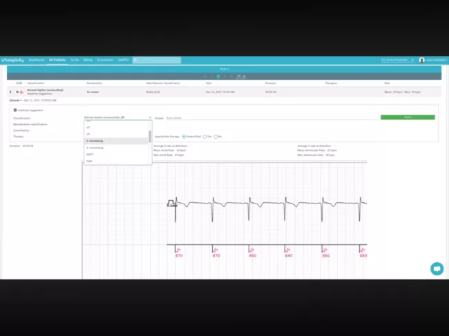 ILR ECG Analyzer software screenshot