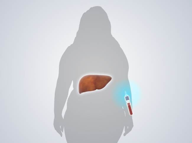 Illustration of liver, blood vial overlaid on woman's silhouette