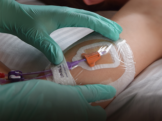 Interrad and Eloquest partner to expand US sales of Securacath | BioWorld Interrad and Eloquest partner to expand US sales of Securacath | BioWorld