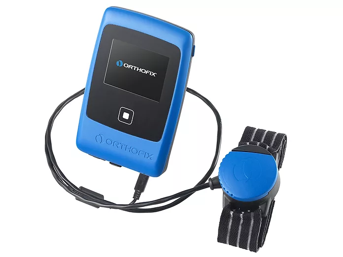 05-04-Orthofix-AccelStim.webp?