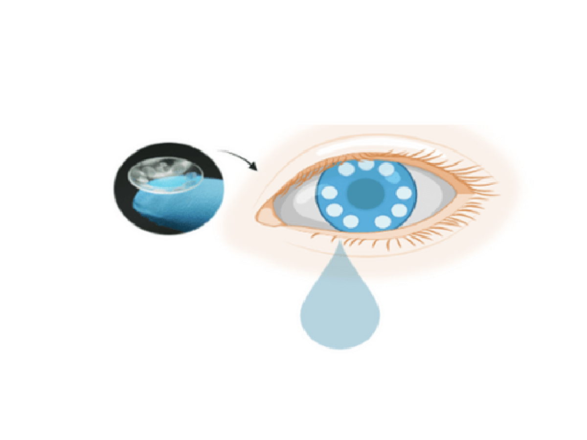 Smart contact lens detects cancer using tears | BioWorld