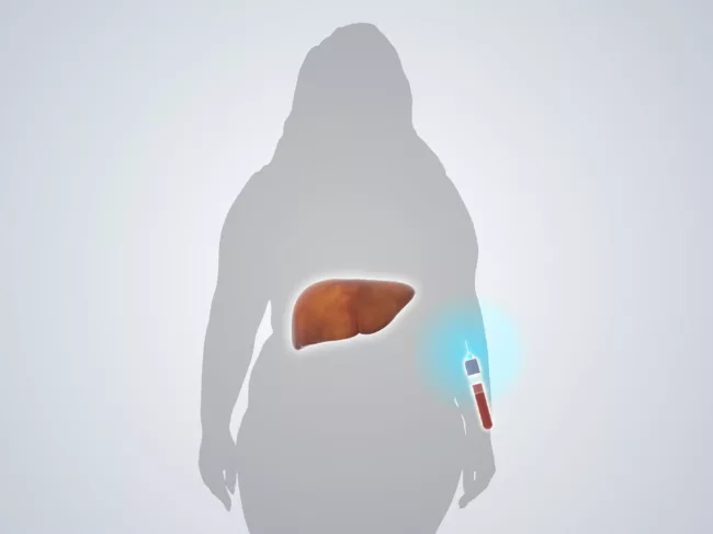Illustration of liver, blood vial overlaid on woman's silhouette