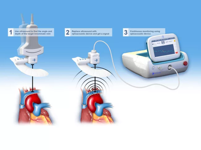 Concept illustration of the Livox system