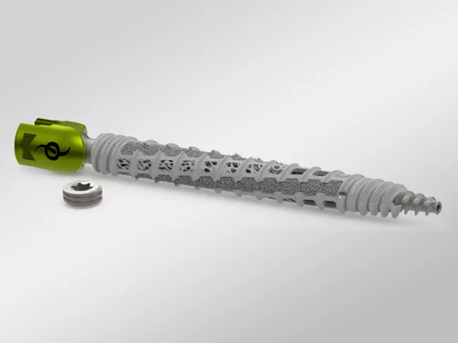 Ifuse Bedrock Granite Implant