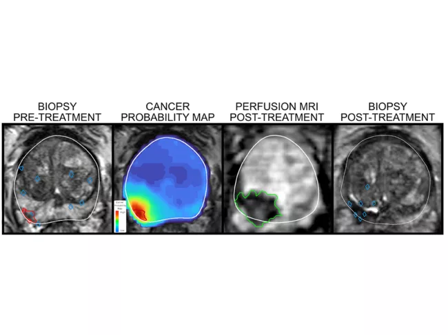 FocalPoint Poweredby iQuest