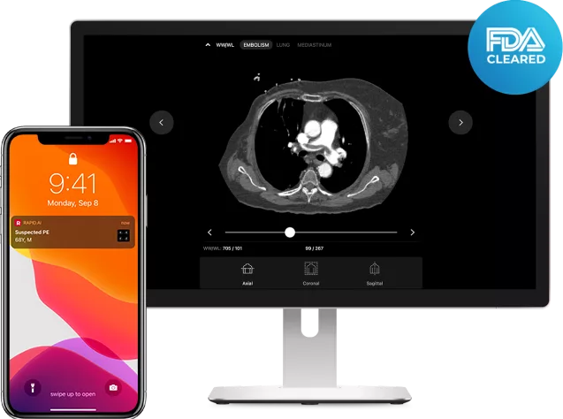 Rapid PE Triage & Notification product