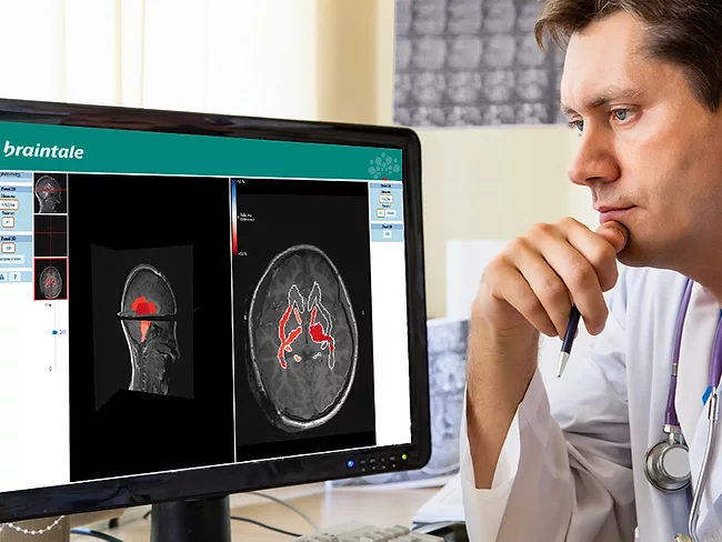 Brainquant - Braintale