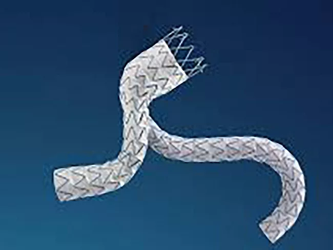 Medtronic - Endurant stent graft