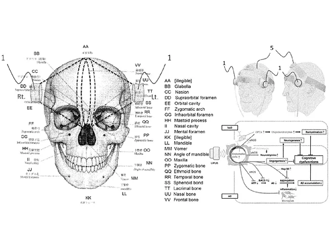 ultrasound therapy heart disease