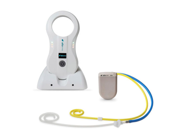Alfapump system from Sequana Medical