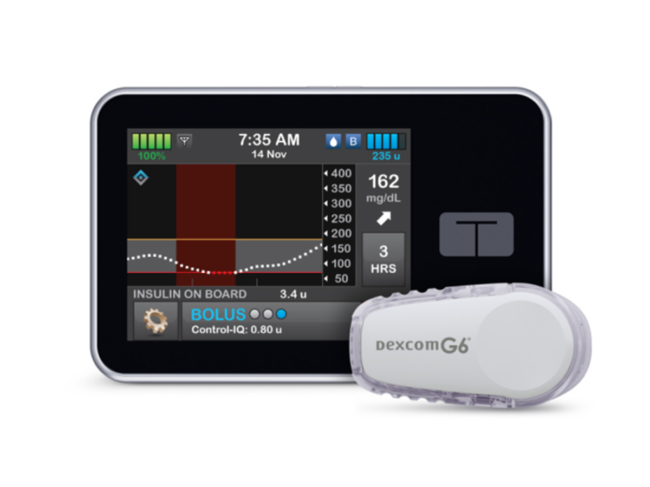 T:slim X2 insulin pump with Control-IQ and Dexcom CGM