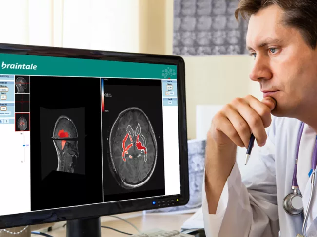 Brainquant - Braintale