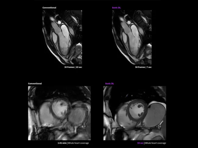 Sonic DL imaging vs. conventional
