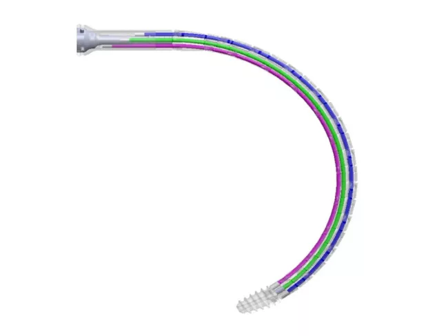 Transparent view of IM implant device, demonstrating locking cables inside