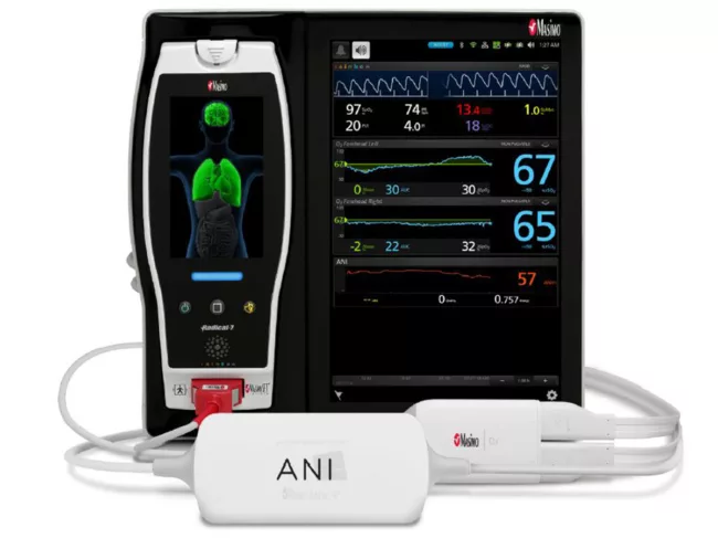 Mdolores analgesia system