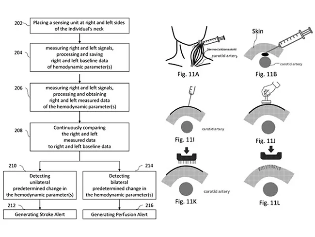 Averrto brain blood flow monitor