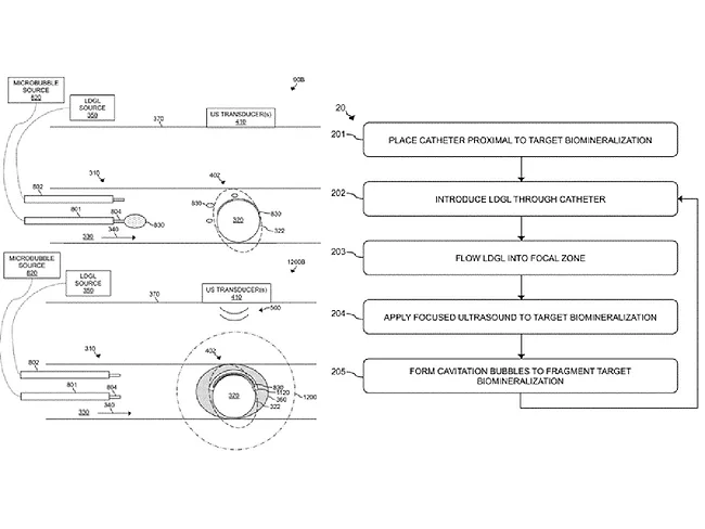 acoustic enhancer tech