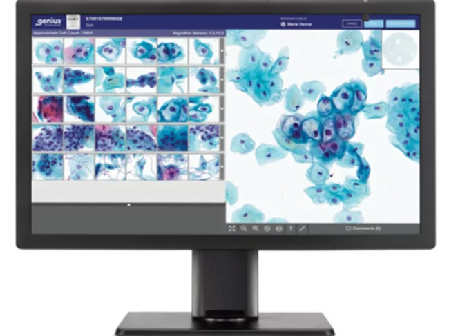 Hologic Genius Review Station